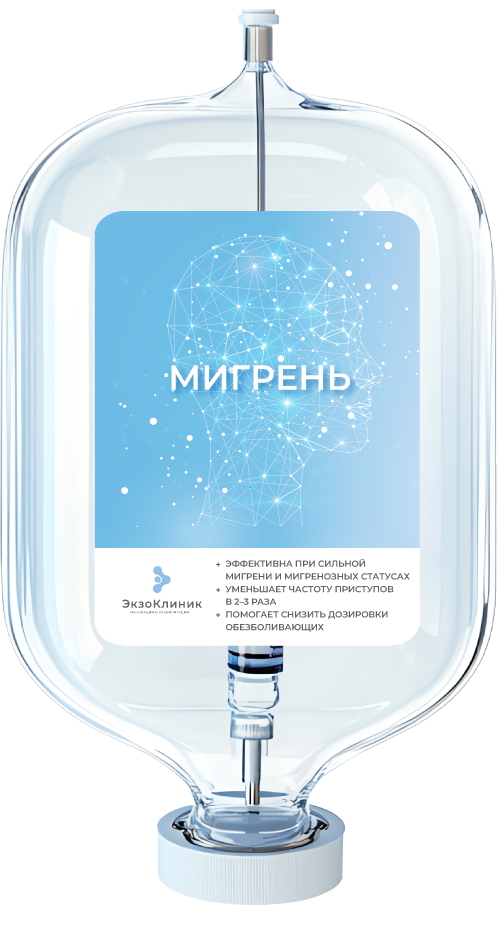 Мигрень